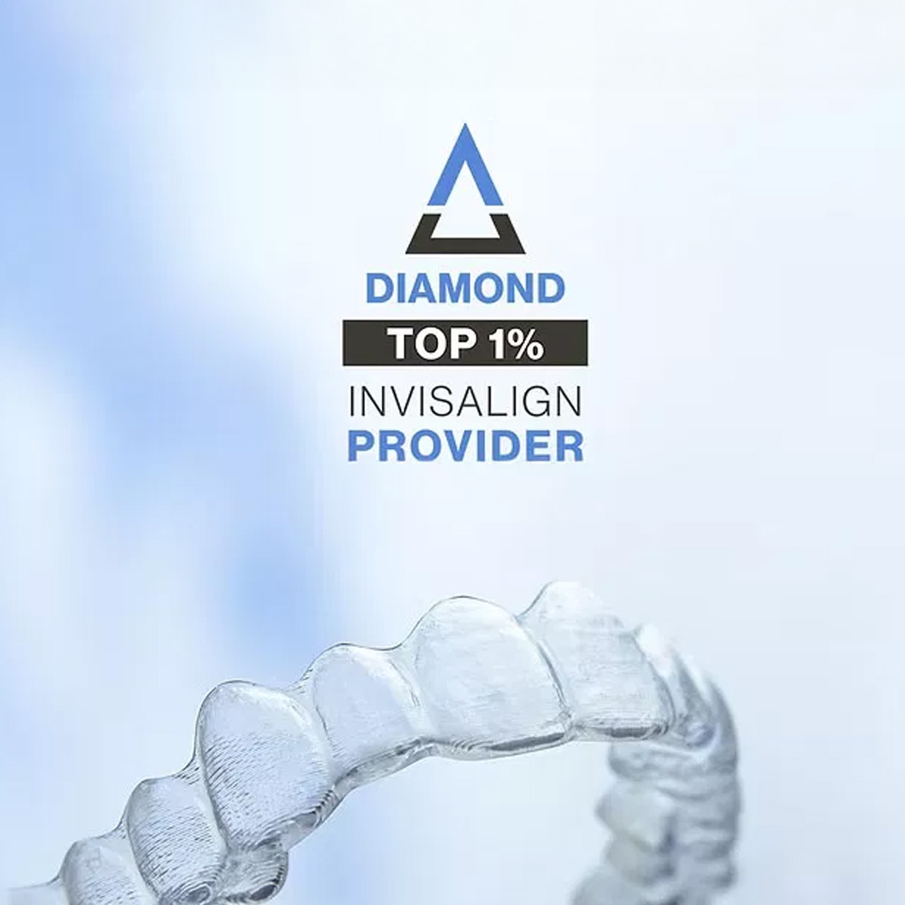 The image displays a clear plastic dental aligner with text overlaying it, which includes branding for 'DIAMOND' at the top, a percentage symbol followed by '10%', and the word 'INVISALIGN' beneath that.