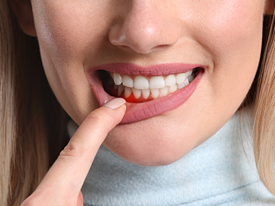 A young woman with a toothbrush in her mouth, brushing her teeth.