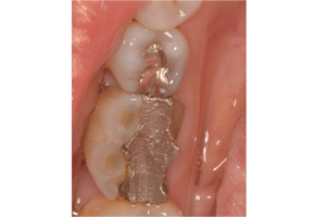 Pediatric Dentist in Burton MI