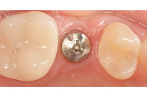 Airway Focused Orthodontics in Burton MI